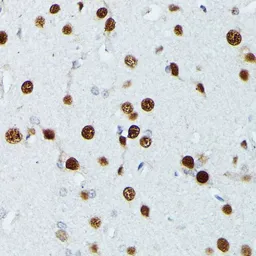 Anti-MEF2C antibody used in IHC (Paraffin sections) (IHC-P). GTX33312