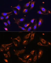 Anti-Melanophilin antibody used in Immunocytochemistry/ Immunofluorescence (ICC/IF). GTX33313