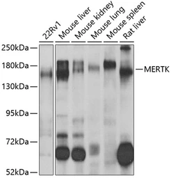 Anti-MERTK antibody used in Western Blot (WB). GTX33314