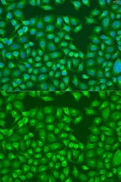 Anti-MERTK antibody used in Immunocytochemistry/ Immunofluorescence (ICC/IF). GTX33314