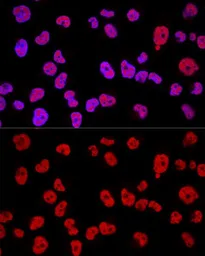 Anti-METTL3 antibody used in Immunocytochemistry/ Immunofluorescence (ICC/IF). GTX33315