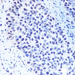 Anti-METTL3 antibody used in IHC (Paraffin sections) (IHC-P). GTX33315