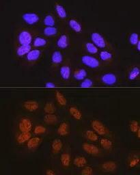 Anti-METTL3 antibody used in Immunocytochemistry/ Immunofluorescence (ICC/IF). GTX33315