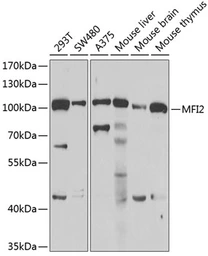 Anti-MFI2 antibody used in Western Blot (WB). GTX33316