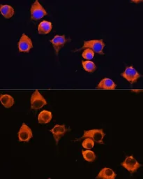 Anti-MFI2 antibody used in Immunocytochemistry/ Immunofluorescence (ICC/IF). GTX33316