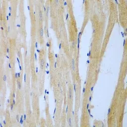 Anti-MGAT3 antibody used in IHC (Paraffin sections) (IHC-P). GTX33317
