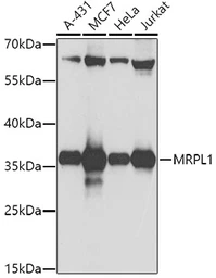 Anti-MRPL1 antibody used in Western Blot (WB). GTX33325