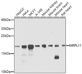 Anti-MRPL11 antibody used in Western Blot (WB). GTX33326