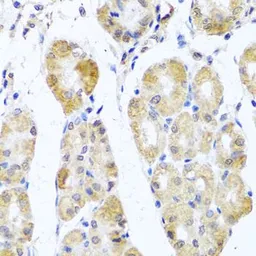 Anti-MRPL11 antibody used in IHC (Paraffin sections) (IHC-P). GTX33326