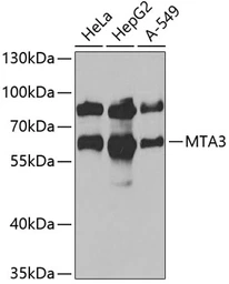 Anti-MTA3 antibody used in Western Blot (WB). GTX33328
