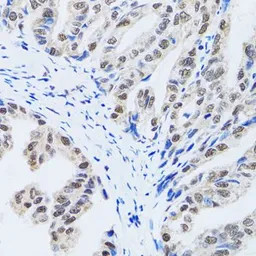 Anti-MTA3 antibody used in IHC (Paraffin sections) (IHC-P). GTX33328