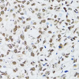 Anti-MTA3 antibody used in IHC (Paraffin sections) (IHC-P). GTX33328
