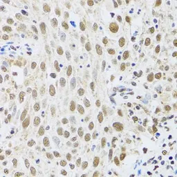 Anti-MTA3 antibody used in IHC (Paraffin sections) (IHC-P). GTX33328