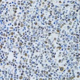 Anti-MTA3 antibody used in IHC (Paraffin sections) (IHC-P). GTX33328