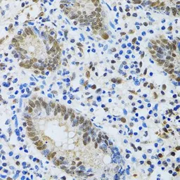 Anti-MTA3 antibody used in IHC (Paraffin sections) (IHC-P). GTX33328
