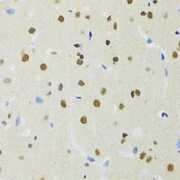 Anti-MTA3 antibody used in IHC (Paraffin sections) (IHC-P). GTX33328