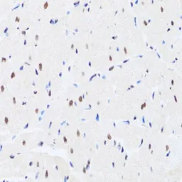 Anti-MTA3 antibody used in IHC (Paraffin sections) (IHC-P). GTX33328