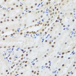Anti-MTA3 antibody used in IHC (Paraffin sections) (IHC-P). GTX33328