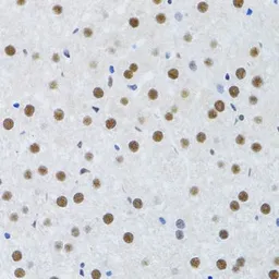 Anti-MTA3 antibody used in IHC (Paraffin sections) (IHC-P). GTX33328