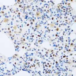 Anti-MTA3 antibody used in IHC (Paraffin sections) (IHC-P). GTX33328