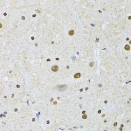 Anti-MTA3 antibody used in IHC (Paraffin sections) (IHC-P). GTX33328