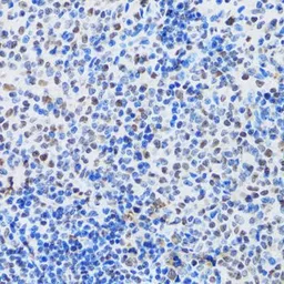 Anti-MTA3 antibody used in IHC (Paraffin sections) (IHC-P). GTX33328