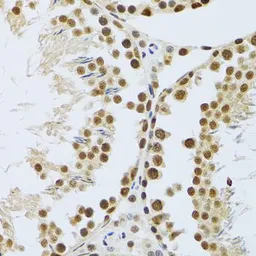 Anti-MTA3 antibody used in IHC (Paraffin sections) (IHC-P). GTX33328