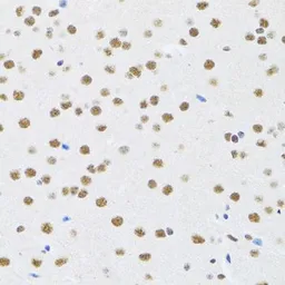 Anti-MTA3 antibody used in IHC (Paraffin sections) (IHC-P). GTX33328