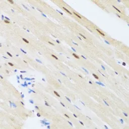 Anti-MTA3 antibody used in IHC (Paraffin sections) (IHC-P). GTX33328