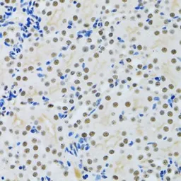Anti-MTA3 antibody used in IHC (Paraffin sections) (IHC-P). GTX33328