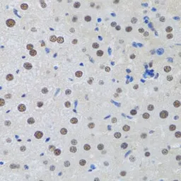 Anti-MTA3 antibody used in IHC (Paraffin sections) (IHC-P). GTX33328