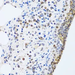 Anti-MTA3 antibody used in IHC (Paraffin sections) (IHC-P). GTX33328