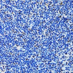 Anti-MTA3 antibody used in IHC (Paraffin sections) (IHC-P). GTX33328