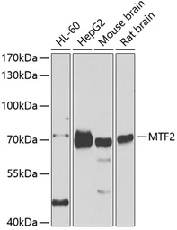 Anti-MTF2 antibody used in Western Blot (WB). GTX33330