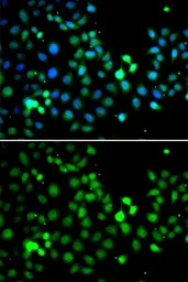 Anti-MTF2 antibody used in Immunocytochemistry/ Immunofluorescence (ICC/IF). GTX33330