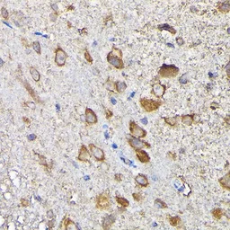 Anti-MTHFD1L antibody used in IHC (Paraffin sections) (IHC-P). GTX33331