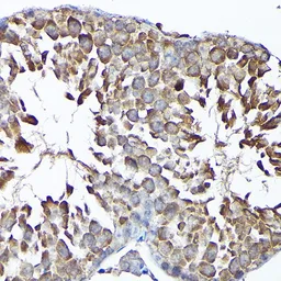 Anti-MTHFD1L antibody used in IHC (Paraffin sections) (IHC-P). GTX33331