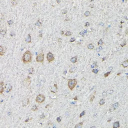 Anti-MTHFD1L antibody used in IHC (Paraffin sections) (IHC-P). GTX33331