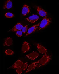 Anti-MTX2 antibody used in Immunocytochemistry/ Immunofluorescence (ICC/IF). GTX33333