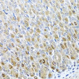 Anti-MTX2 antibody used in IHC (Paraffin sections) (IHC-P). GTX33333