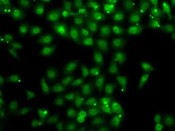 Anti-Muscleblind-like 1 antibody used in Immunocytochemistry/ Immunofluorescence (ICC/IF). GTX33335