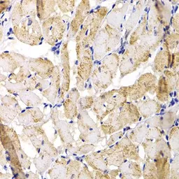 Anti-Muscleblind-like 1 antibody used in IHC (Paraffin sections) (IHC-P). GTX33335