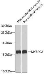 Anti-MYBPC2 antibody used in Western Blot (WB). GTX33336