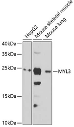 Anti-Myosin Light Chain 3 antibody used in Western Blot (WB). GTX33340