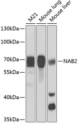 Anti-NAB2 antibody used in Western Blot (WB). GTX33342