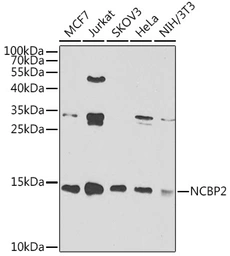 Anti-NCBP2 antibody used in Western Blot (WB). GTX33345