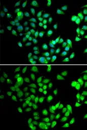 Anti-NCBP2 antibody used in Immunocytochemistry/ Immunofluorescence (ICC/IF). GTX33345