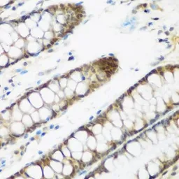 Anti-NCBP2 antibody used in IHC (Paraffin sections) (IHC-P). GTX33345