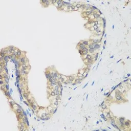 Anti-NCBP2 antibody used in IHC (Paraffin sections) (IHC-P). GTX33345
