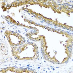 Anti-Nck beta antibody used in IHC (Paraffin sections) (IHC-P). GTX33346